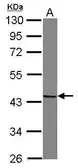 Anti-Snurportin 1 antibody [N1C2] used in Western Blot (WB). GTX115340