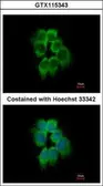 Anti-p41-ARCb antibody used in Immunocytochemistry/ Immunofluorescence (ICC/IF). GTX115343