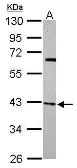 Anti-p41-ARCb antibody used in Western Blot (WB). GTX115343