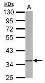 Anti-p41-ARCb antibody [N2C2], Internal used in Western Blot (WB). GTX115344
