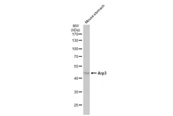 Anti-Arp3 antibody used in Western Blot (WB). GTX115345