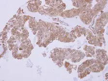 Anti-ACTR1B antibody used in IHC (Paraffin sections) (IHC-P). GTX115347