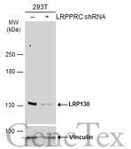 Anti-LRP130 antibody [N2N3] used in Western Blot (WB). GTX115351