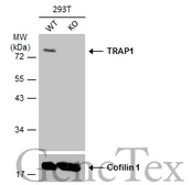 Anti-TRAP1 antibody [N1N3] used in Western Blot (WB). GTX115352