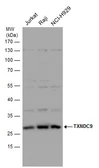 Anti-TXNDC9 antibody used in Western Blot (WB). GTX115365