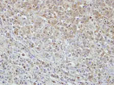 Anti-MPHOSPH6 antibody [N1C3] used in IHC (Paraffin sections) (IHC-P). GTX115368