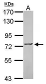 Anti-ZNF443 antibody [N1N2], N-term used in Western Blot (WB). GTX115372