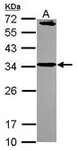 Anti-Syntaxin 6 antibody [N1C3] used in Western Blot (WB). GTX115375
