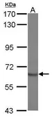 Anti-STAM2 antibody [N1N3] used in Western Blot (WB). GTX115382