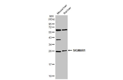 Anti-SIGMAR1 antibody [N1C3] used in Western Blot (WB). GTX115389