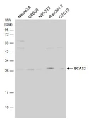 Anti-BCAS2 antibody used in Western Blot (WB). GTX115390