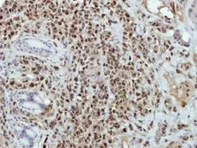 Anti-BRAF35 antibody [N2C3] used in IHC (Paraffin sections) (IHC-P). GTX115399