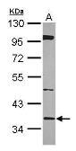 Anti-BRAF35 antibody [N2C3] used in Western Blot (WB). GTX115399