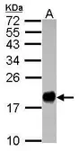 Anti-IFITM3 antibody used in Western Blot (WB). GTX115407