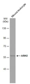 Anti-ARIH2 antibody used in Western Blot (WB). GTX115410
