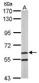 Anti-ARIH2 antibody [C1C3] used in Western Blot (WB). GTX115411