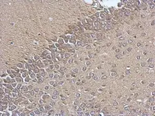 Anti-TIM17 antibody used in IHC (Paraffin sections) (IHC-P). GTX115414