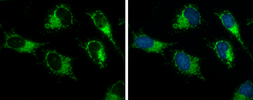 Anti-ACAA2 antibody used in Immunocytochemistry/ Immunofluorescence (ICC/IF). GTX115416