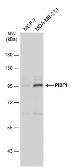 Anti-PIBF1 antibody used in Western Blot (WB). GTX115423