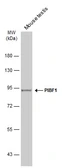 Anti-PIBF1 antibody used in Western Blot (WB). GTX115423