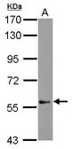 Anti-DEAF1 antibody [N2C2], Internal used in Western Blot (WB). GTX115430