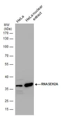 Anti-RNAse H2A antibody used in Western Blot (WB). GTX115433