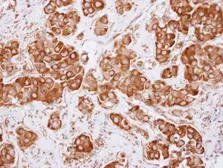 Anti-DCTN2 antibody used in IHC (Paraffin sections) (IHC-P). GTX115435