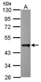 Anti-DCTN2 antibody used in Western Blot (WB). GTX115435