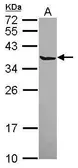 Anti-SCGN antibody [N1C2] used in Western Blot (WB). GTX115442