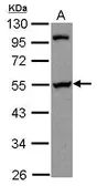 Anti-PAIP1 antibody [N3C3] used in Western Blot (WB). GTX115446