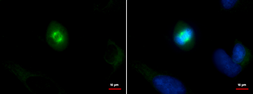 Anti-SPAG5 antibody used in Immunocytochemistry/ Immunofluorescence (ICC/IF). GTX115449