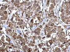 Anti-RBCK1 antibody used in IHC (Paraffin sections) (IHC-P). GTX115451