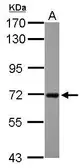 Anti-RGS14 antibody [C1C3] used in Western Blot (WB). GTX115456