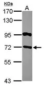 Anti-RGS14 antibody [N1N3] used in Western Blot (WB). GTX115457