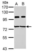 Anti-IMP3 antibody used in Western Blot (WB). GTX115459