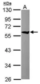 Anti-TCP1 theta antibody used in Western Blot (WB). GTX115466