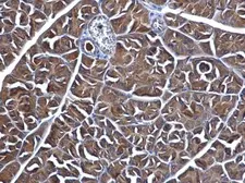 Anti-MGEA5 antibody used in IHC (Paraffin sections) (IHC-P). GTX115467