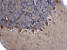 Anti-MGEA5 antibody used in IHC (Paraffin sections) (IHC-P). GTX115467