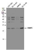 Anti-RBBP9 antibody used in Western Blot (WB). GTX115469