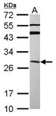 Anti-GRAP antibody [N1C3] used in Western Blot (WB). GTX115471