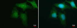 Anti-HBS1L antibody used in Immunocytochemistry/ Immunofluorescence (ICC/IF). GTX115473