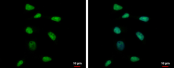 Anti-RPP40 antibody used in Immunocytochemistry/ Immunofluorescence (ICC/IF). GTX115483