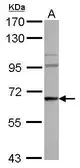 Anti-WASF3 antibody used in Western Blot (WB). GTX115486