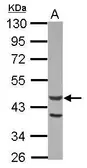 Anti-ACTL7A antibody [C1C3] used in Western Blot (WB). GTX115496