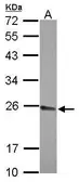 Anti-CPSF4 antibody [N1C3] used in Western Blot (WB). GTX115498