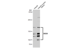 Anti-BRD8 antibody [C1C2], Internal used in Western Blot (WB). GTX115500