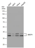 Anti-SUGT1 antibody used in Western Blot (WB). GTX115502