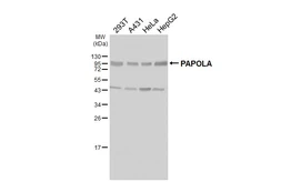 Anti-PAPOLA antibody used in Western Blot (WB). GTX115503