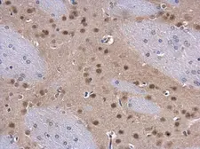 Anti-COPS8 antibody used in IHC (Paraffin sections) (IHC-P). GTX115506