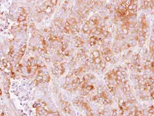 Anti-TMED2 antibody [N1C3-2] used in IHC (Paraffin sections) (IHC-P). GTX115514
